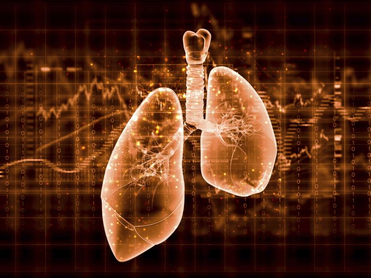 Nem diagnosztizált tüdőrák okozta halálozás Magyarországon