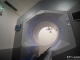 Ultramodern sugárterápiás eszközt avattak az Onkoterápiás Intézetben