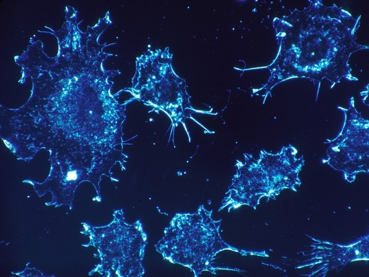 A daganatos sejtek 99 százalékát elpusztította egy új rákterápia