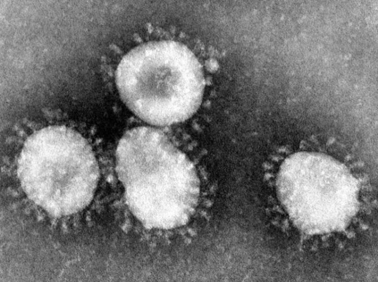 Ezt a 15 tünetet figyelje magán, arat a koronavírus JN.1 variánsa