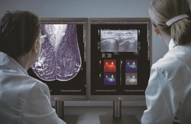 Mammográfiához tervezett diagnosztikai monitort mutat be az LG