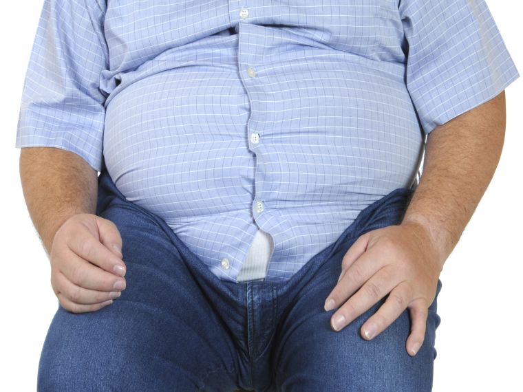 Az elhízás egészségügyi kockázata nagyobb, mint gondolnánk