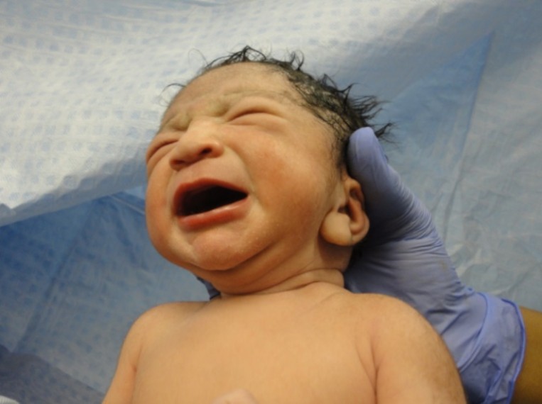 Leállt a szülészet, mégis kisbaba született a szentesi kórházban