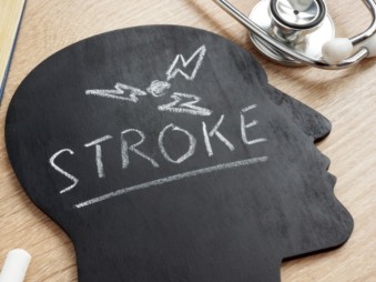 Stroke - a gyors felismerés nyáron is életmentő