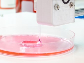 Mi mindenre lehet alkalmas a testen belüli 3D-nyomtatás!