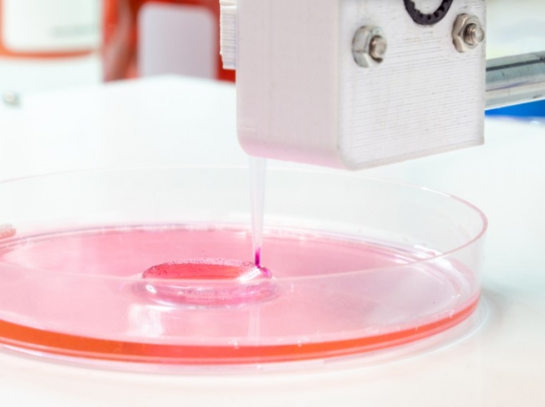 Mi mindenre lehet alkalmas a testen belüli 3D-nyomtatás!