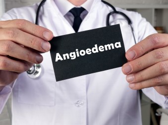 Akár génszerkesztéssel is kezelhetik az angioödémát