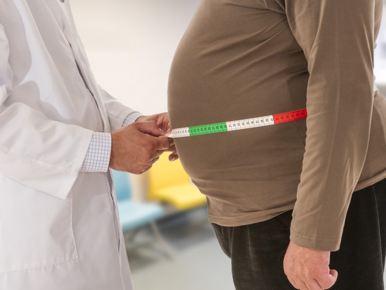 Obezitás gyógyszeres kezelése: nem a kilók lefaragása a cél
