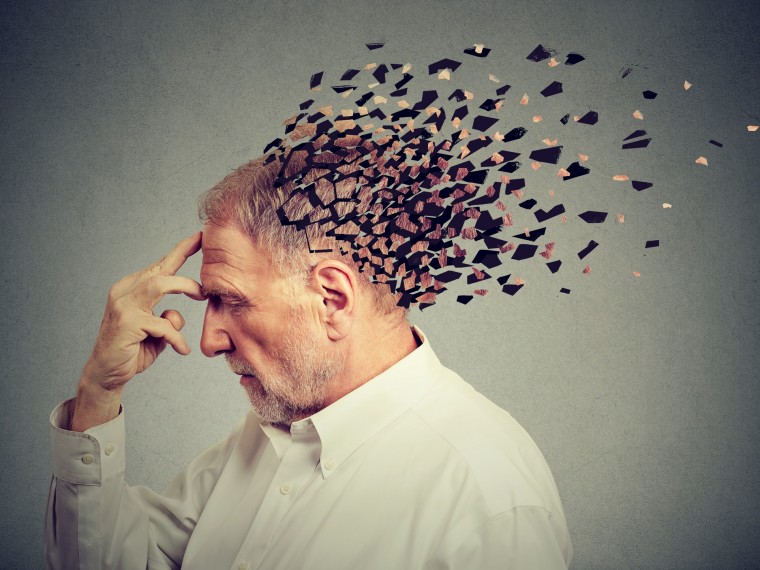 Áttörések az Alzheimer-kór elleni harcban