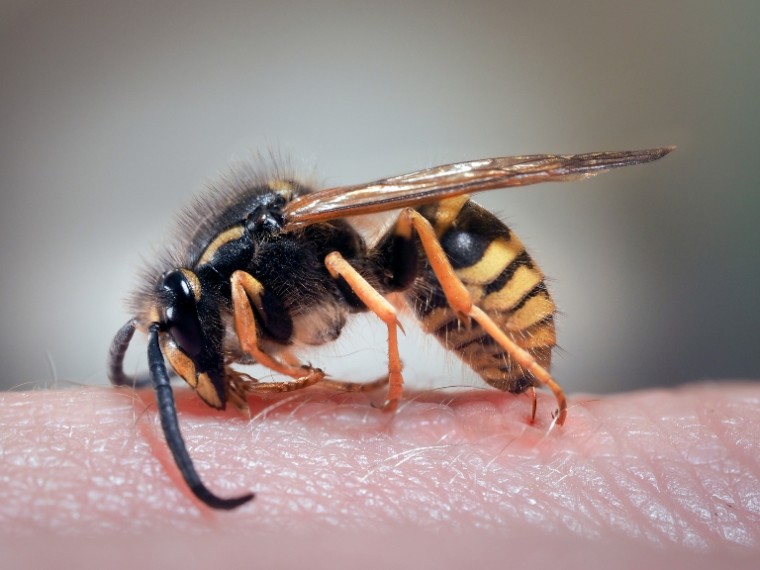 Rovarcsípés: ez az életveszélyes allergia felnőttkorban is kialakulhat