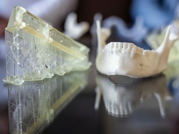 3D tervezéssel végeznek állkapocshelyreállító műtéteket az SE-n