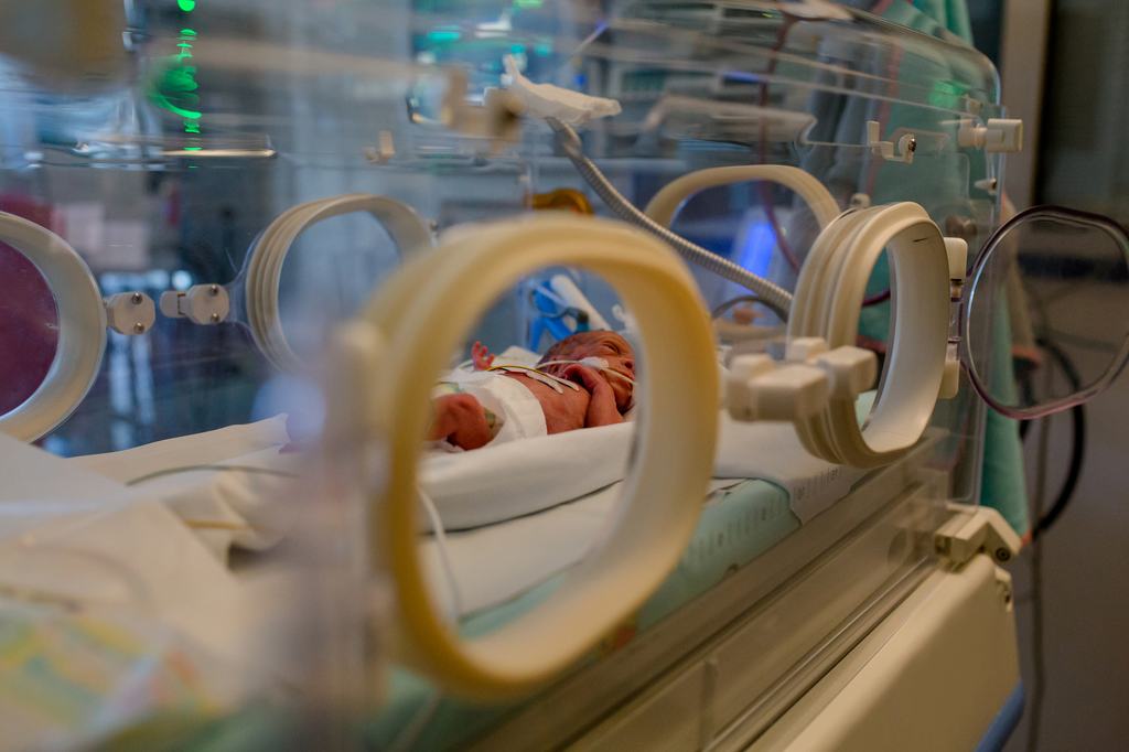 Magyar AI-rendszer teheti folyamatossá a koraszülöttek megfigyelését