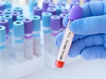Kiknek ajánlott a BRCA-teszt, és mi a jelentősége az onkológiában?