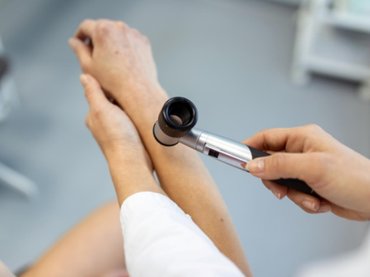 Melanóma világnap: Az esetszámok növekednek, a túlélési esélyek javulnak