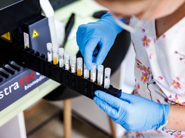 Forradalmi áttörés az Alzheimer-kór korai felismerésében