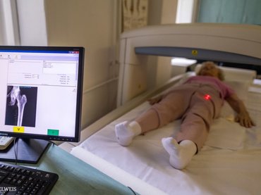 Csontritkulás: 3x valószínűbb, hogy az első törést újabb követi