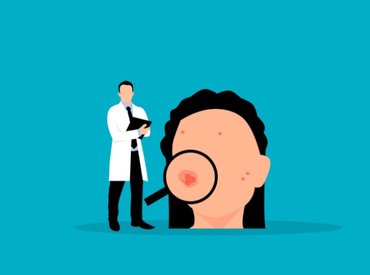 Drámai mértékben nő az angol melanomás esetek száma