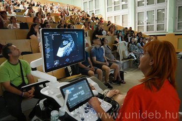 Nyíltan a szülésről