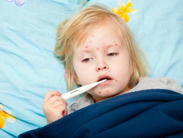 Bárányhimlő vs. övsömör – ugyanaz a kórokozó, más a betegség