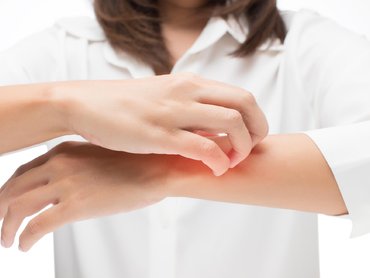 13 dolog, ami kiválthatja az atópiás dermatitisz fellángolását