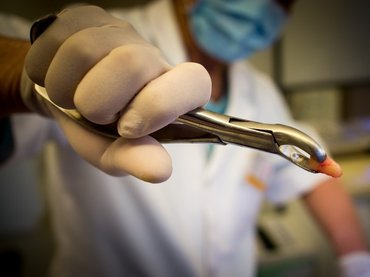 Piacra dobhatják a világ első fognövesztő gyógyszerét