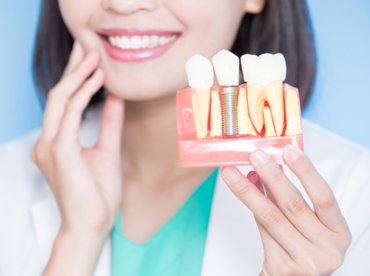 Mit okozhat a foghiány, és miért érdemes időben lépni?