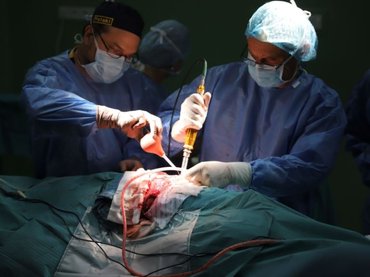 Sikeresen szétválasztották a fejüknél összenőtt bangladesi sziámi ikreket