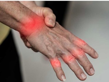 Ínhüvelygyulladás: Hogyan szüntethető meg a fájdalom?