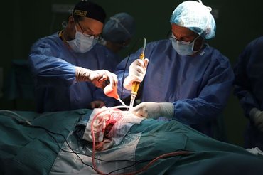 Ezeknek köszönhető a sziámi ikrek sikeres szétválasztása