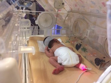 Miért van szükség külön koraszülöttmentésre?