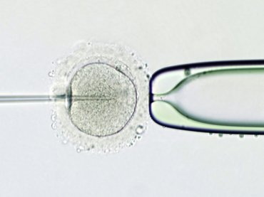 Szigorúan szabályozzák a petesejt adományozását