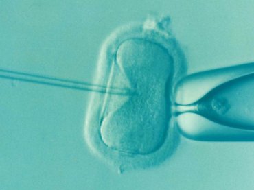 Ennyibe kerül egy lombik-élet