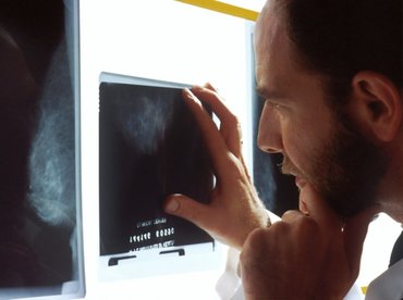 Méhnyakrák-szűrésre a behívottak mindössze két százaléka megy el