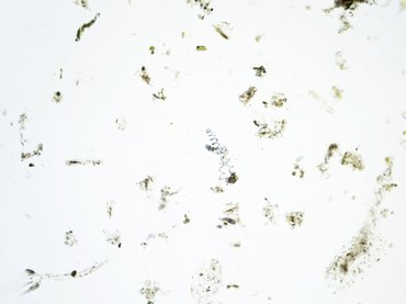 Hatással van a Lyme-kór a májra?