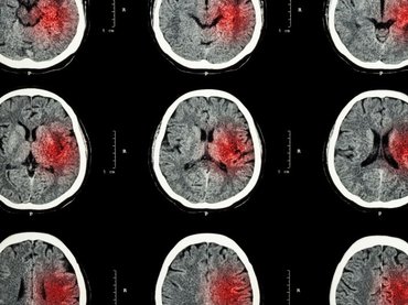 Az influenzaoltás nem csak az influenza ellen véd