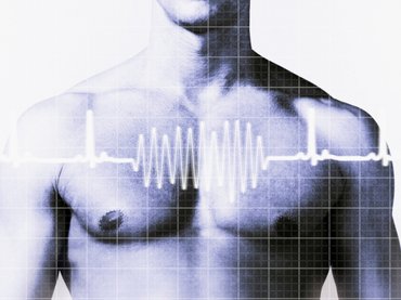 Szívmegállás: hetekkel korábban lehetnek előjelei