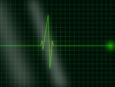 Ingyenes szűrővizsgálatokra várnak mindenkit