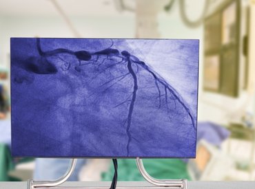 Új szívkatéteres laboratóriumot adtak át a Szegedi Tudományegyetemen