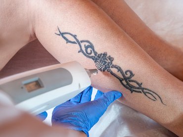 Szabályoznák a tetováláshoz használható festékeket