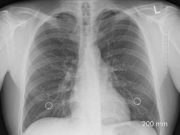 Mérgező a magyar forgácsoló üzemek levegője