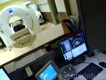 Debrecen is csatlakozik a tüdőrákszűrési programhoz