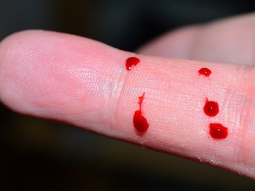 Egy új eszköz megkönnyíti a rákos betegek életét