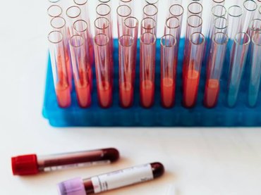 Folyékony vért találtak egy 42 000 éves lóban