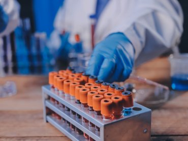 Tíz évre megmondja a stroke - és infarktus-veszélyt egy vérvizsgálat